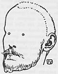 Jules Renard vu par F&eacute;lix Vallotton.